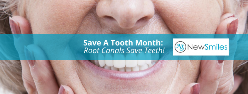 Root Canals Save Teeth