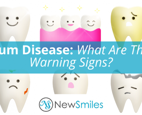 Gum Disease Warning Signs