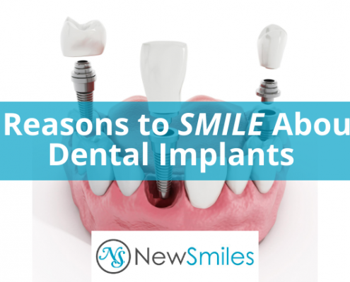 6 Reasons to Smile About Dental Implants