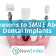 6 Reasons to Smile About Dental Implants