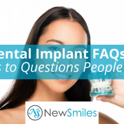Dental Implant FAQs By Dr Manjula Alapati DDS
